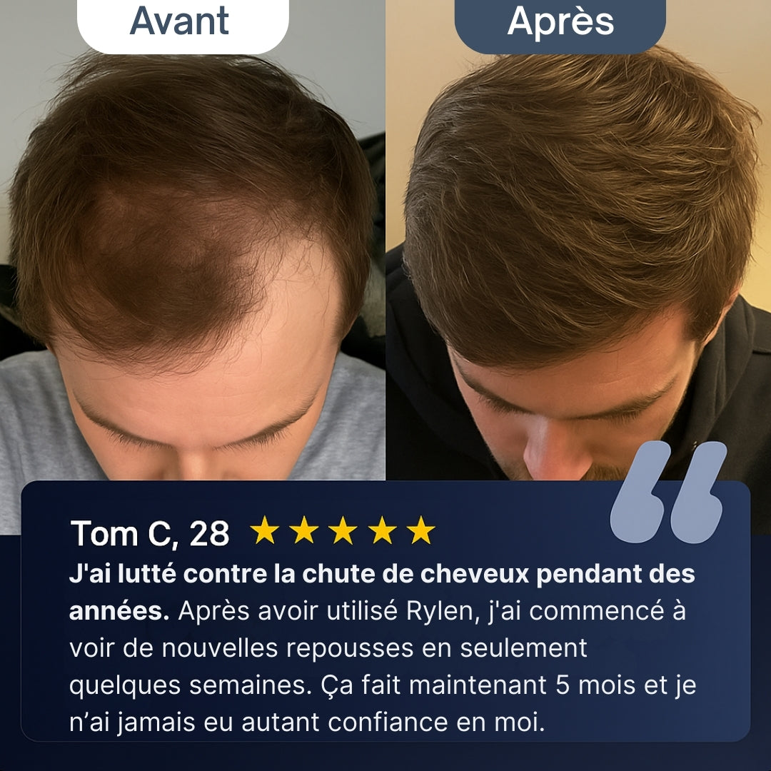 Sérum Repousse Cheveux