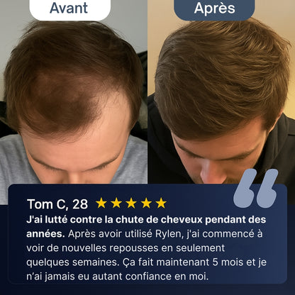 Sérum Repousse Cheveux
