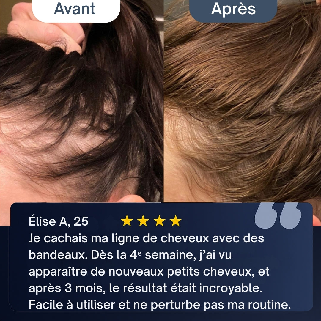 Sérum Repousse Cheveux