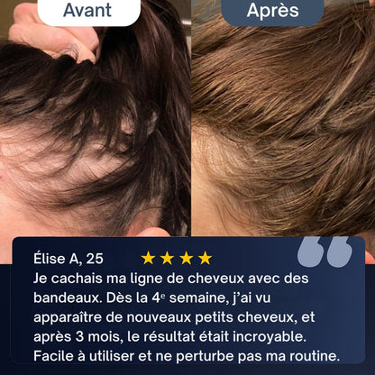 Sérum Repousse Cheveux